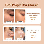 Face Brightening Kit. Milk Powder Face Wash & Milk Drops Brightening Serum. #227