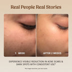 Face Brightening Kit. Milk Powder Face Wash & Milk Drops Brightening Serum. #227