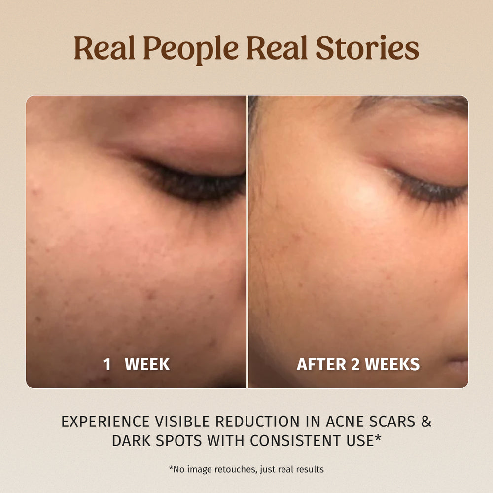 Face Brightening Kit. Milk Powder Face Wash & Milk Drops Brightening Serum. #227