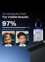Reginald hair growth serum 30ml| #279
