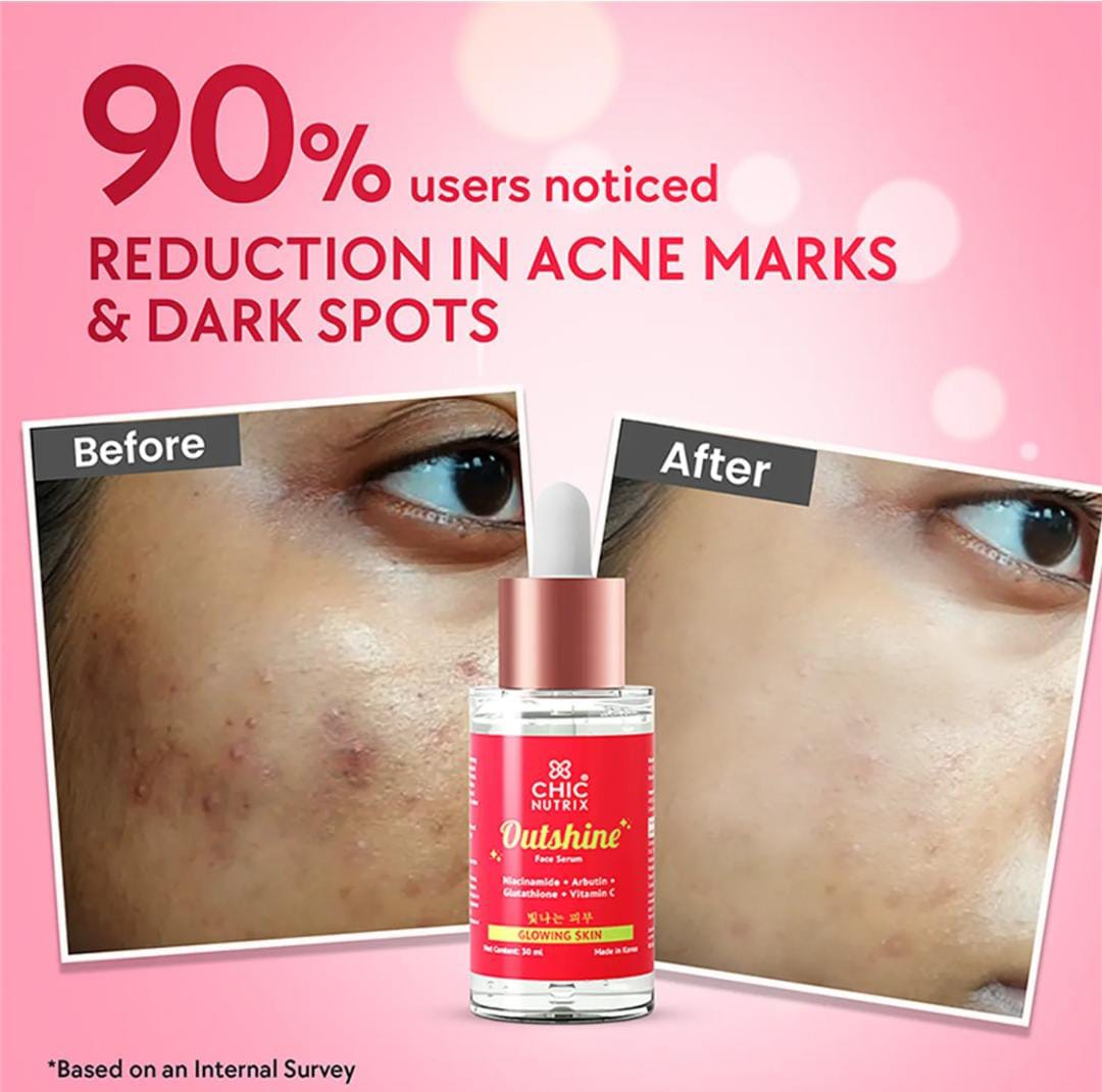 Chiknutrix. Outshine Face Glow Serum | 30ml