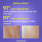 Exfoliating Body Wash with 4% Lactic Acid, Salicylic Acid & Vit E, Treats Back Acne 236ml