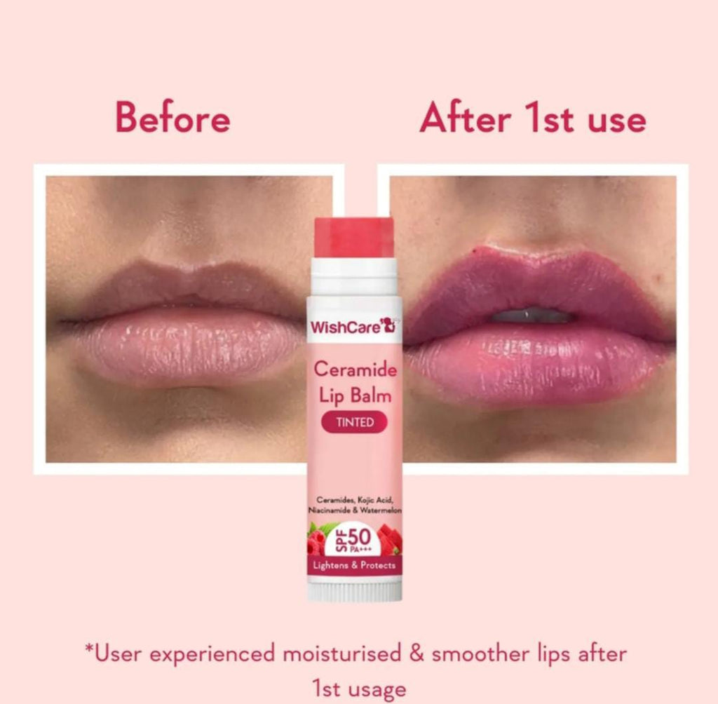 Tinted Ceramide Lip Balm with SPF50 PA+++ -Kojic Acid & Niacinamide - For Lip Lightening | 5g
