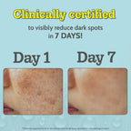 10% Vitamin C Face Serum Brightens Skin | Treats Dark Spots & Hyperpigmentation | 30ml