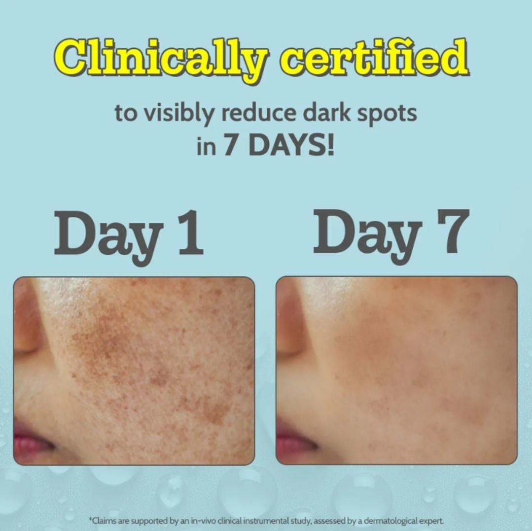 10% Vitamin C Face Serum Brightens Skin | Treats Dark Spots & Hyperpigmentation | 30ml