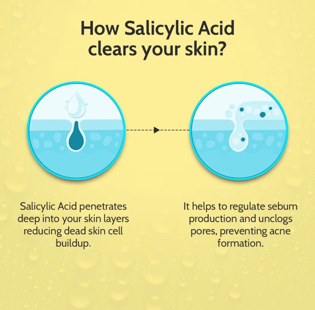 Chemist at Play. Face Serum Treats Active Acne, Controls Excess Oil | 30ml