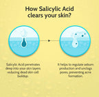 Chemist at Play. Face Serum Treats Active Acne, Controls Excess Oil | 30ml