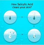 Chemist at Play. Face Serum Treats Active Acne, Controls Excess Oil | 30ml