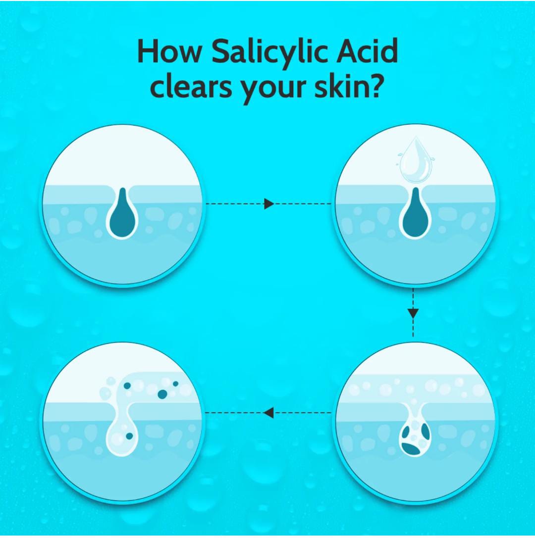 Chemist at Play. Face Serum Treats Active Acne, Controls Excess Oil | 30ml