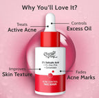 Chemist at Play. Face Serum Treats Active Acne, Controls Excess Oil | 30ml