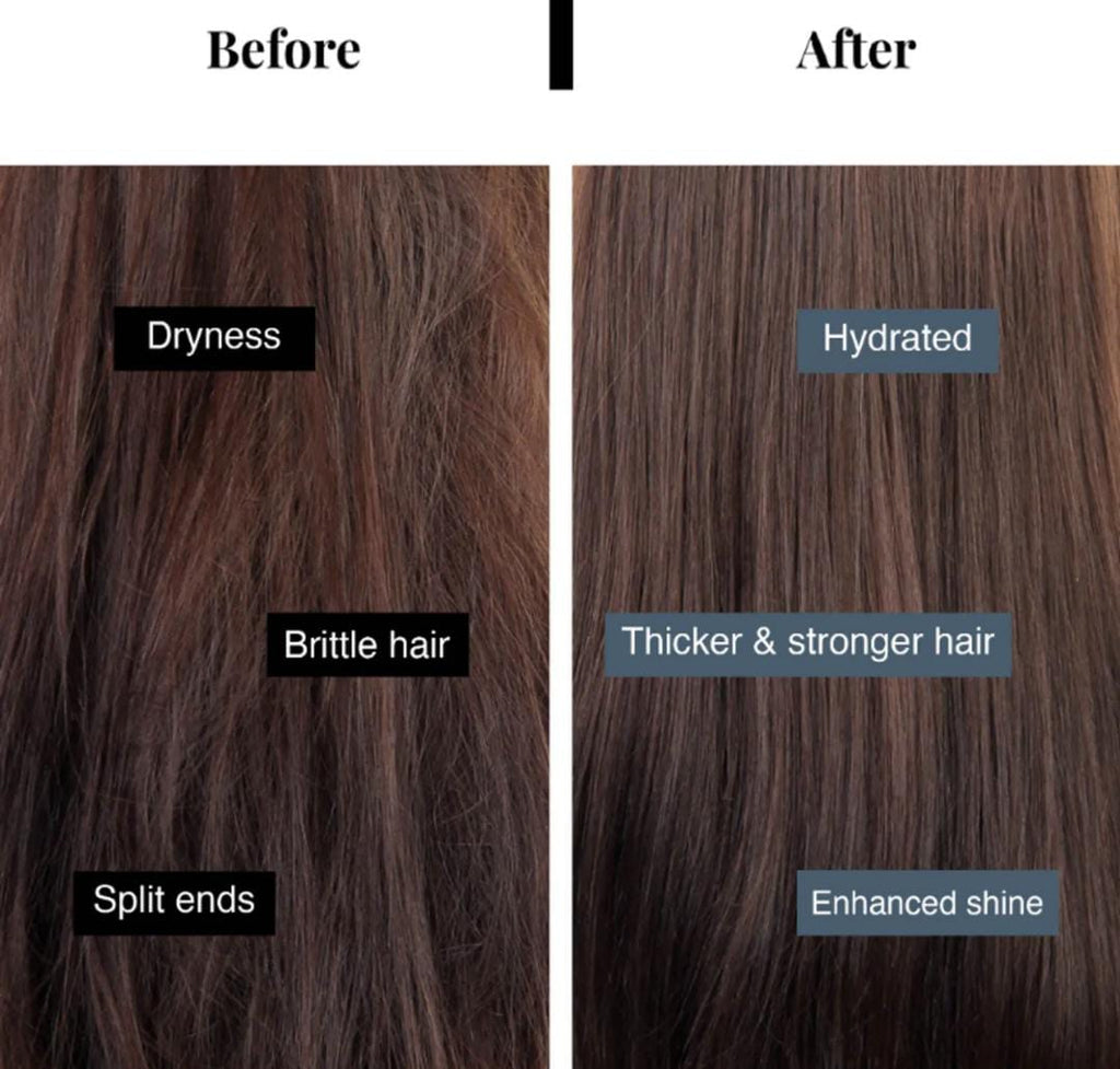 Bare Anatomy 5X Hair Fall Control Shampoo | 250ml | #193