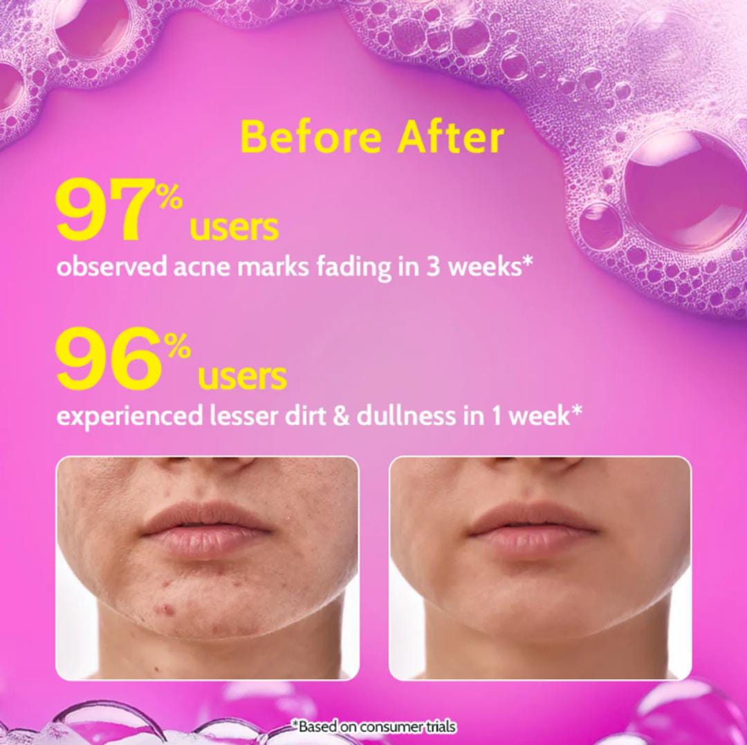 2% Salicylic Acid Face Wash For Oily Skin with Niacinamide Oil Cleanser for Face | 100ml