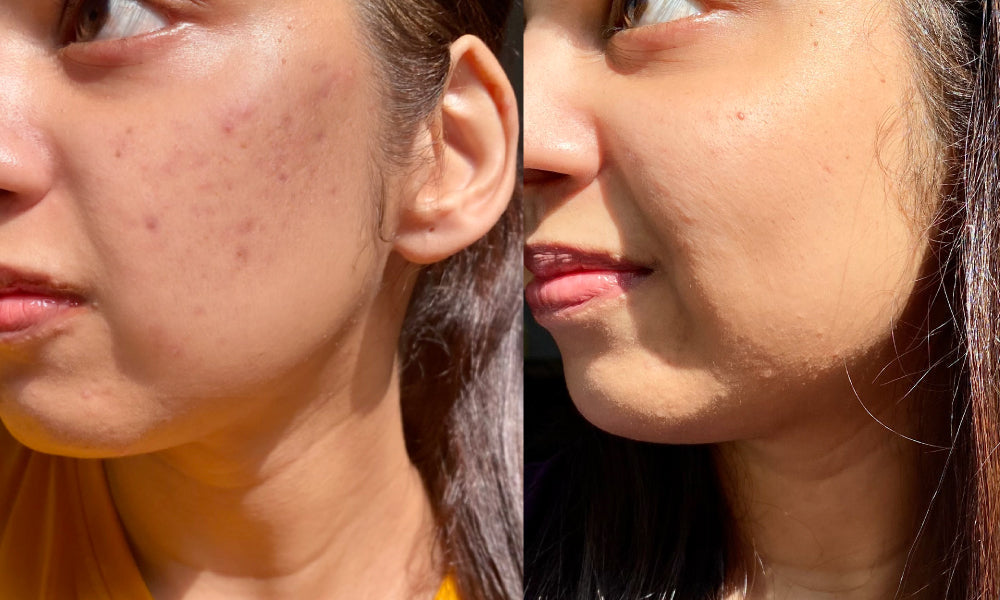 Face Brightening Kit. Milk Powder Face Wash & Milk Drops Brightening Serum. #227