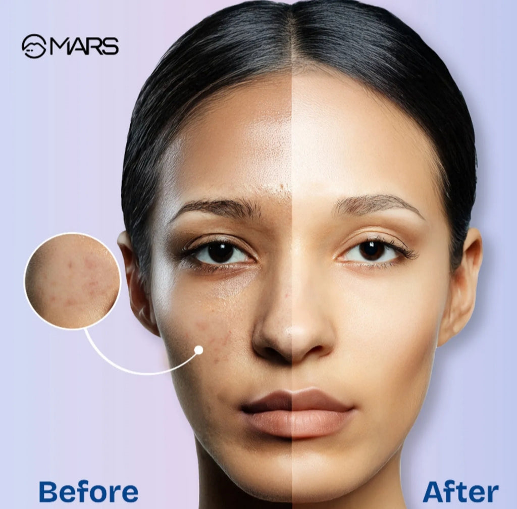 MARS Oil Blotter Gel Compact | 5g